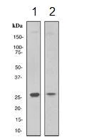 Western blot - Anti-MXD3/MAD3 antibody [EPR3882] (AB108525)