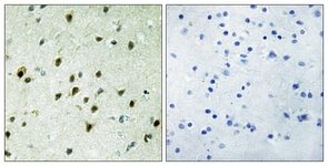Immunohistochemistry (Formalin/PFA-fixed paraffin-embedded sections) - Anti-MXD4/MAD4 antibody (AB111062)
