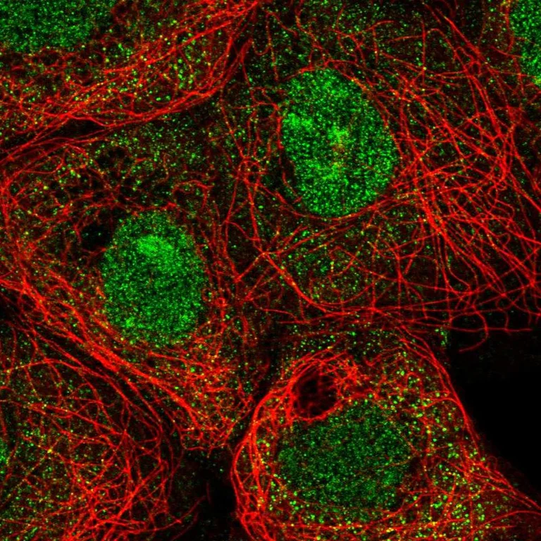 Immunocytochemistry/ Immunofluorescence - Anti-MXI1 Antibody (AB327243)