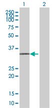 Western blot - MXI1 overexpression 293T lysate (whole cell) (AB94151), expandable thumbnail
