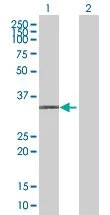 Western blot - MXI1 overexpression 293T lysate (whole cell) (AB94151)