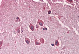 Immunohistochemistry (Formalin/PFA-fixed paraffin-embedded sections) - Anti-MXRA5 antibody (AB211302)