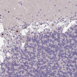 Immunohistochemistry (Formalin/PFA-fixed paraffin-embedded sections) - Anti-MXRA8/Asp3 antibody (AB185444)