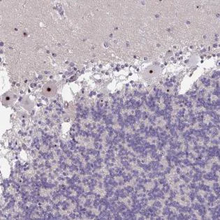 Immunohistochemistry (Formalin/PFA-fixed paraffin-embedded sections) - Anti-MXRA8/Asp3 antibody (AB185444)