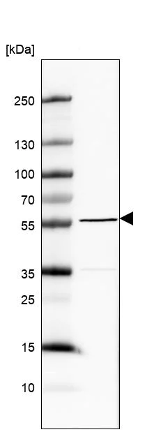Western blot - Anti-MXRA8/Asp3 antibody (AB185444)