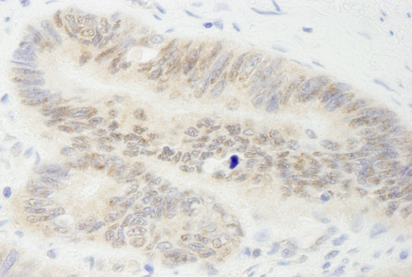 Immunohistochemistry (Formalin/PFA-fixed paraffin-embedded sections) - Anti-MYBBP1A antibody (AB99361)