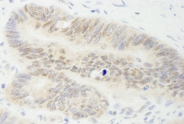 Immunohistochemistry (Formalin/PFA-fixed paraffin-embedded sections) - Anti-MYBBP1A antibody (AB99361)