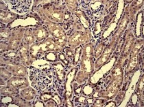 Immunohistochemistry (Formalin/PFA-fixed paraffin-embedded sections) - Anti-MYBBP1A antibody [EPR7204] (AB125026)