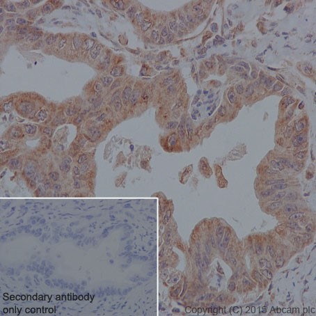 Immunohistochemistry (Formalin/PFA-fixed paraffin-embedded sections) - Anti-MYBBP1A antibody [EPR7205] (AB202896)