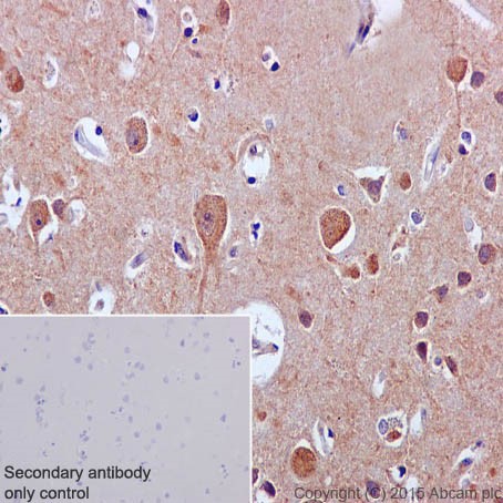 Immunohistochemistry (Formalin/PFA-fixed paraffin-embedded sections) - Anti-MYBBP1A antibody [EPR7205] (AB202896)