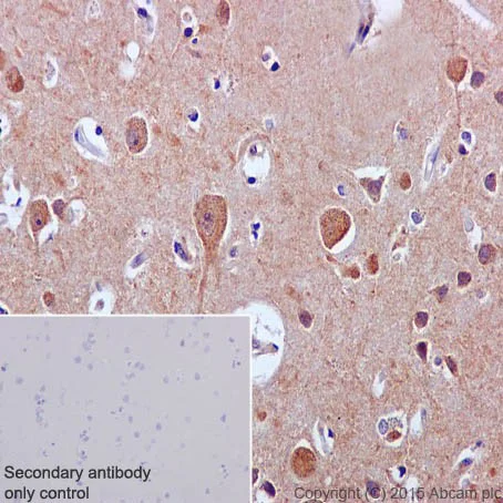 Immunohistochemistry (Formalin/PFA-fixed paraffin-embedded sections) - Anti-MYBBP1A antibody [EPR7205] - BSA and Azide free (AB251384)