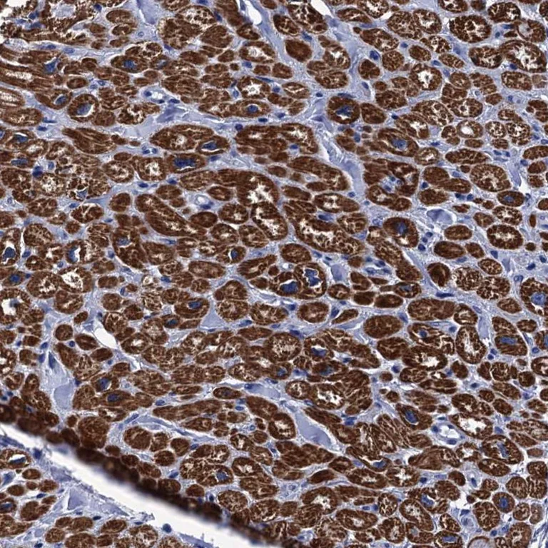 Immunohistochemistry (Formalin/PFA-fixed paraffin-embedded sections) - Anti-MYBPC3 antibody (AB262964)