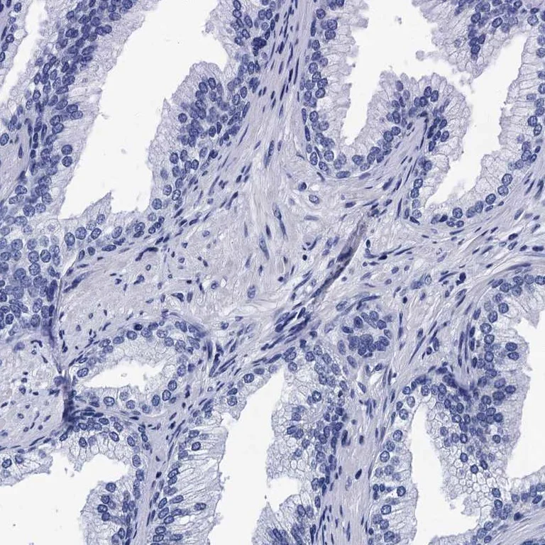 Immunohistochemistry (Formalin/PFA-fixed paraffin-embedded sections) - Anti-MYBPC3 antibody (AB262964)