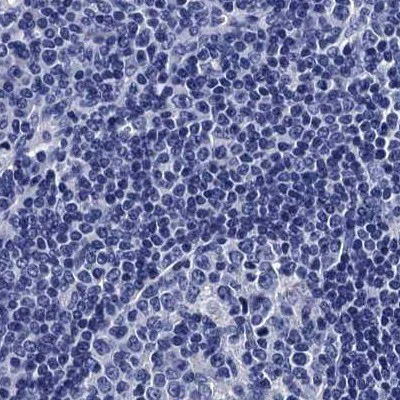 Immunohistochemistry (Formalin/PFA-fixed paraffin-embedded sections) - Anti-MYBPC3 antibody (AB262964)
