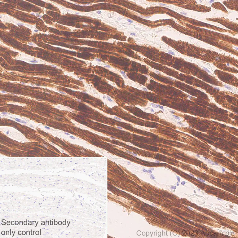 Immunohistochemistry (Formalin/PFA-fixed paraffin-embedded sections) - Anti-MYBPC3 antibody [EPR25673-58] (AB308619)
