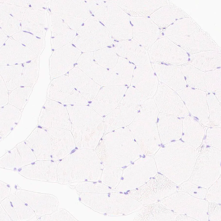 Immunohistochemistry (Formalin/PFA-fixed paraffin-embedded sections) - Anti-MYBPC3 antibody [EPR25673-58] (AB308619)