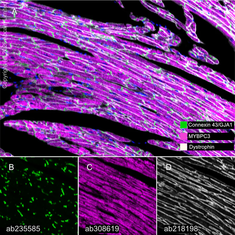 Multiplex immunohistochemistry - Anti-MYBPC3 antibody [EPR25673-58] (AB308619)