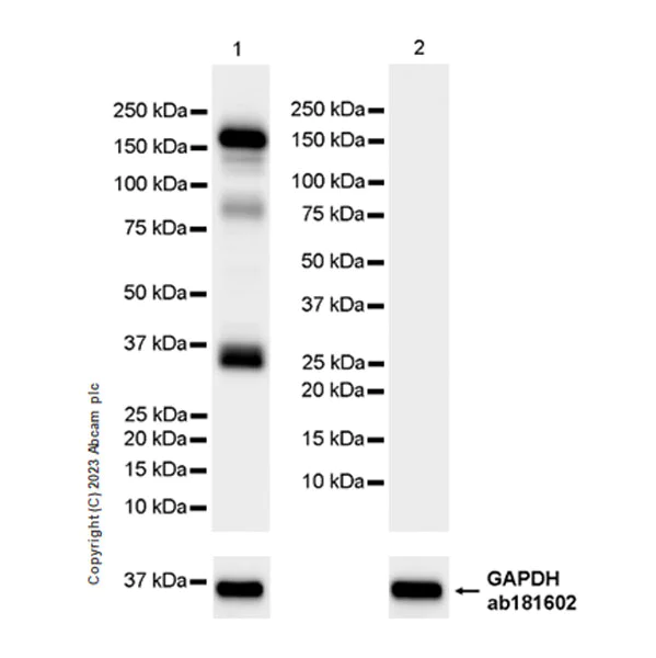 Western blot - Anti-MYBPC3 antibody [EPR25673-58] (AB308619)
