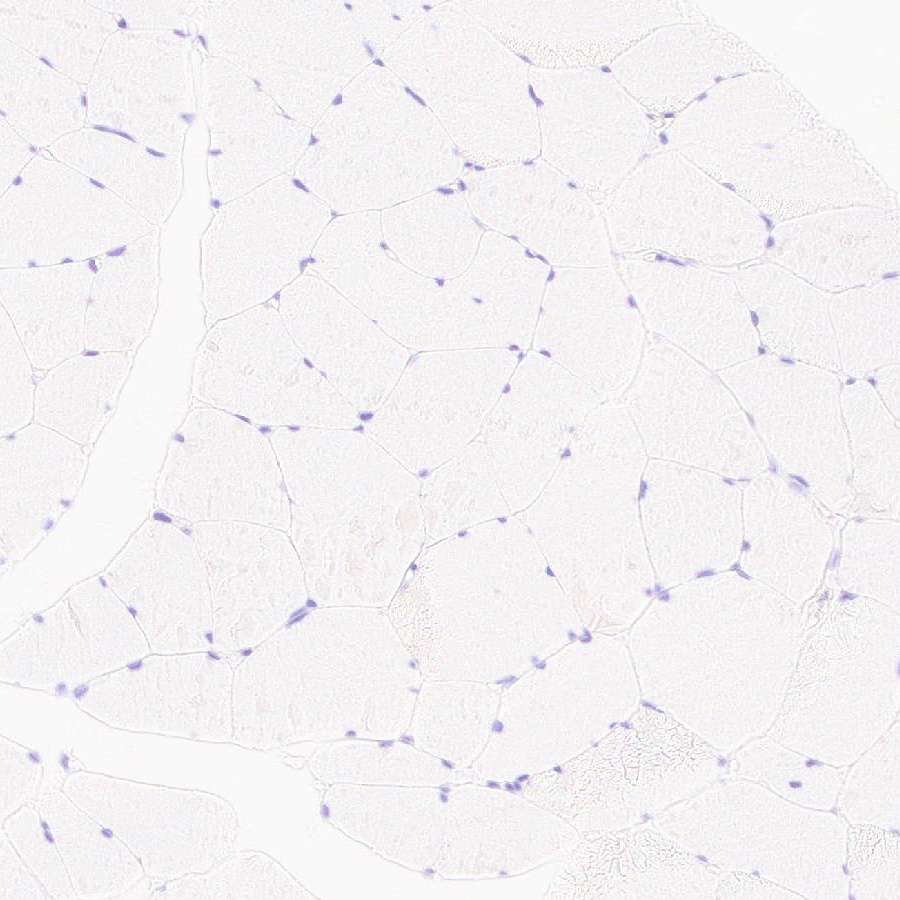 Immunohistochemistry (Formalin/PFA-fixed paraffin-embedded sections) - Anti-MYBPC3 antibody [EPR25673-58] - BSA and Azide free (AB308620), expandable thumbnail