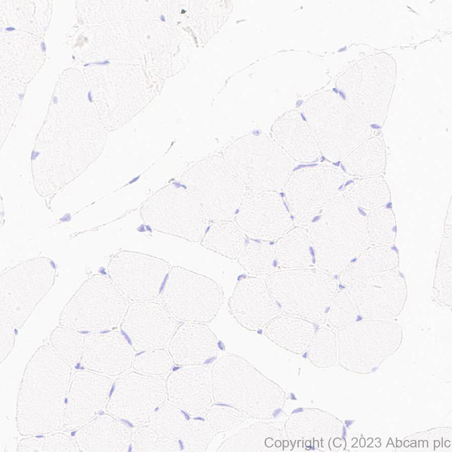 Immunohistochemistry (Formalin/PFA-fixed paraffin-embedded sections) - Anti-MYBPC3 antibody [EPR25673-58] - BSA and Azide free (AB308620), expandable thumbnail