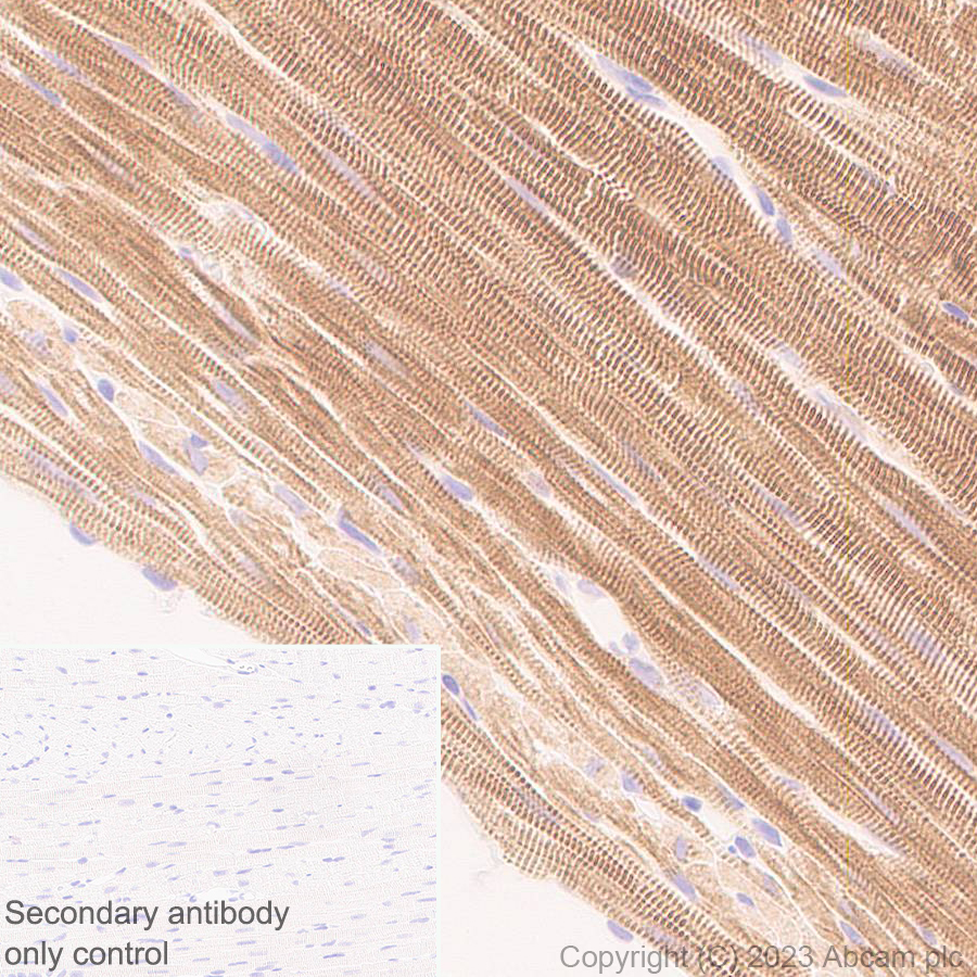 Immunohistochemistry (Formalin/PFA-fixed paraffin-embedded sections) - Anti-MYBPC3 antibody [EPR25673-58] - BSA and Azide free (AB308620), expandable thumbnail