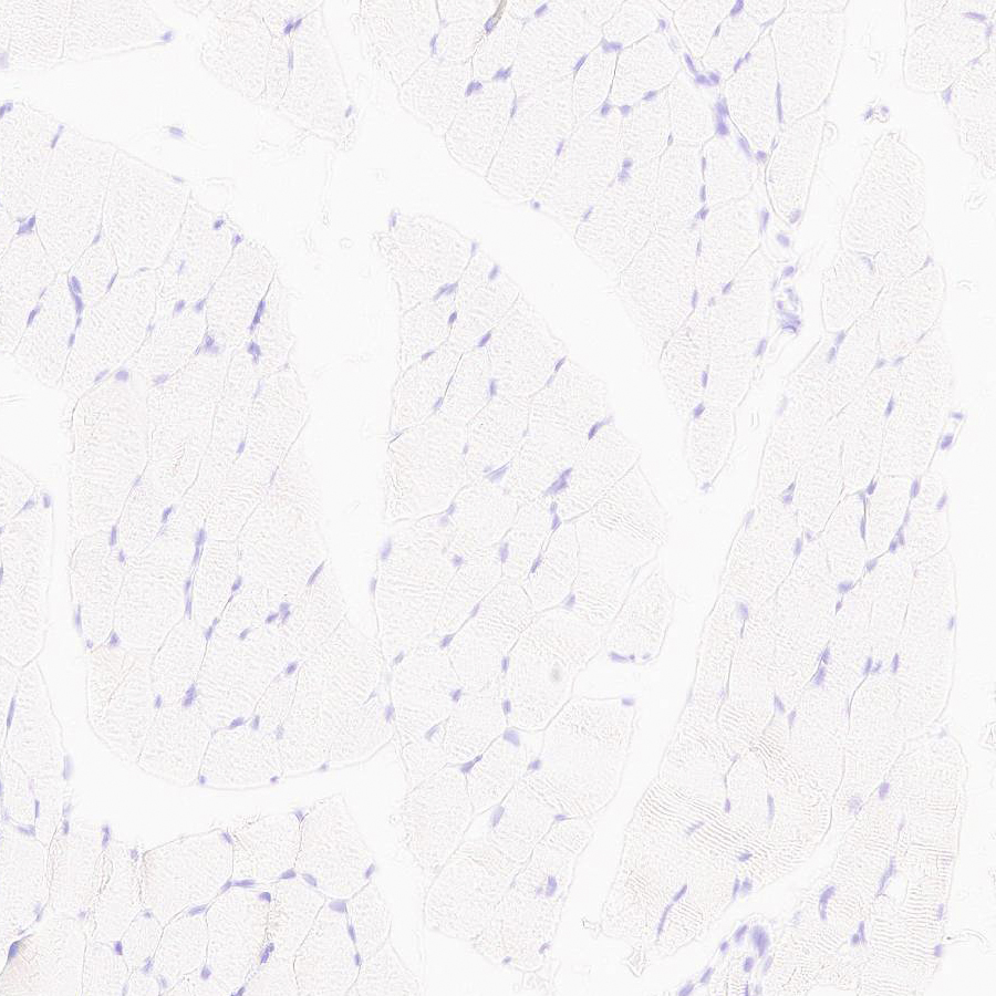 Immunohistochemistry (Formalin/PFA-fixed paraffin-embedded sections) - Anti-MYBPC3 antibody [EPR25673-58] - BSA and Azide free (AB308620), expandable thumbnail