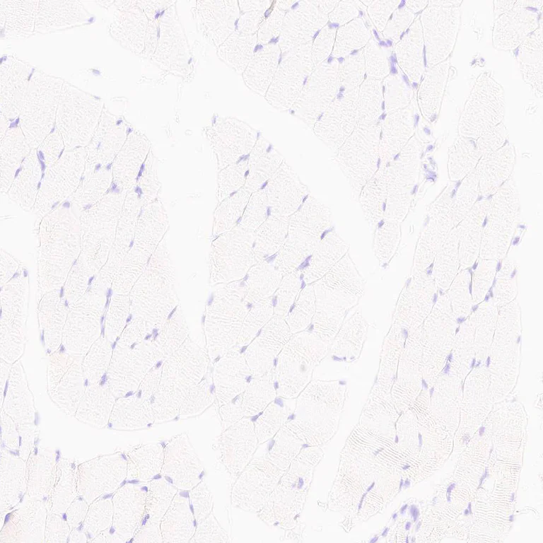 Immunohistochemistry (Formalin/PFA-fixed paraffin-embedded sections) - Anti-MYBPC3 antibody [EPR25673-58] - BSA and Azide free (AB308620)