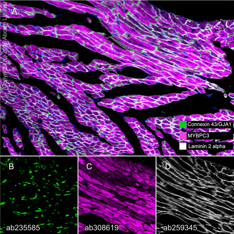 Multiplex immunohistochemistry - Anti-MYBPC3 antibody [EPR25673-58] - BSA and Azide free (AB308620)