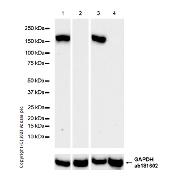 Western blot - Anti-MYBPC3 antibody [EPR25673-58] - BSA and Azide free (ab308620), expandable thumbnail