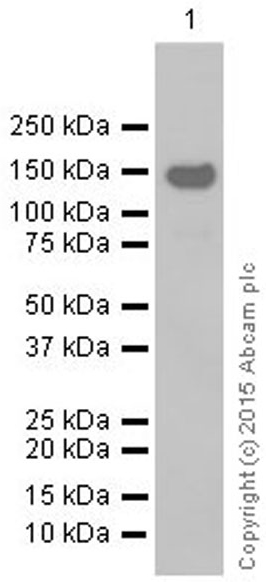 Western blot - Anti-MYBPC3 antibody [EPR3008(2)] - BSA and Azide free (AB203258), expandable thumbnail
