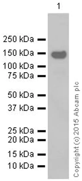 Western blot - Anti-MYBPC3 antibody [EPR3008(2)] - BSA and Azide free (AB203258)
