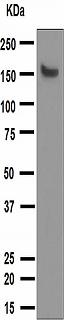Western blot - Anti-MYBPC3 antibody [EPR3008(2)] - BSA and Azide free (AB203258), expandable thumbnail