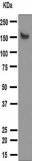 Western blot - Anti-MYBPC3 antibody [EPR3008(2)] - BSA and Azide free (AB203258)