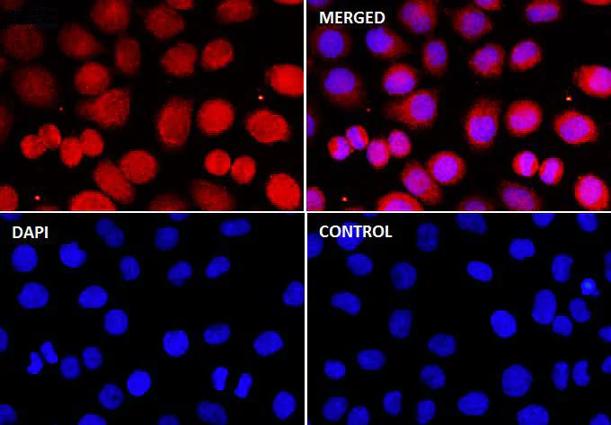 Immunocytochemistry/ Immunofluorescence - Anti-MYC (phospho T58 + S62) antibody [SZ02-06] (AB326617)