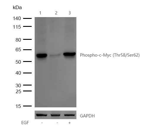 Western blot - Anti-MYC (phospho T58 + S62) antibody [SZ02-06] (AB326617)