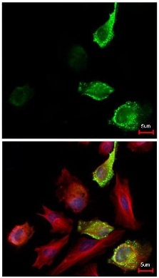 Immunocytochemistry/ Immunofluorescence - Anti-Myc tag antibody (AB152146)