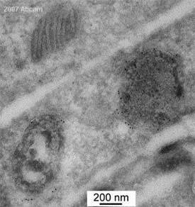 Electron Microscopy - Anti-Myc tag antibody (ab9106), expandable thumbnail