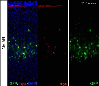 Immunohistochemistry (Formalin/PFA-fixed paraffin-embedded sections) - Anti-Myc tag antibody (ab9106), expandable thumbnail