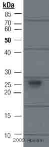 Immunoprecipitation - Anti-Myc tag antibody (AB9106), expandable thumbnail