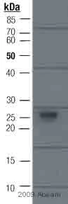 Immunoprecipitation - Anti-Myc tag antibody (AB9106)