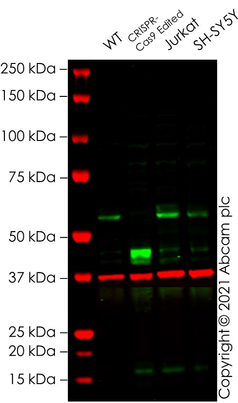 Western blot - Anti-Myc tag antibody [Myc.A7] (AB18185)