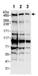 Western blot - Anti-MYCBP2 antibody (AB86078)
