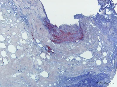 Immunohistochemistry (Formalin/PFA-fixed paraffin-embedded sections) - Anti-Mycobacterium tuberculosis Ag85B antibody (AB43019)