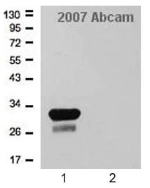 Western blot - Anti-Mycobacterium tuberculosis Ag85B antibody (AB43019)
