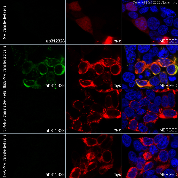 Immunocytochemistry/ Immunofluorescence - Anti-Mycobacterium tuberculosis Ag85B antibody [EPR28401-54] (ab312328), expandable thumbnail