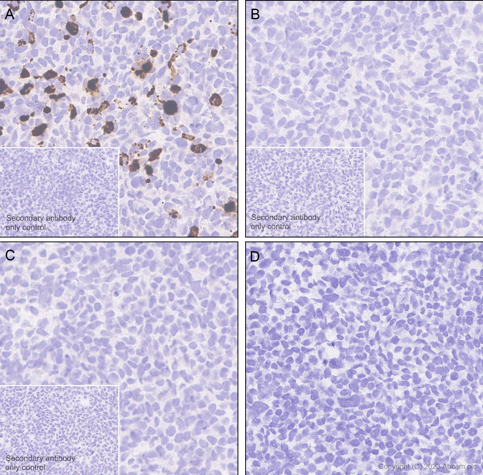 Immunohistochemistry (Formalin/PFA-fixed paraffin-embedded sections) - Anti-Mycobacterium tuberculosis Ag85B antibody [EPR28401-54] (ab312328), expandable thumbnail