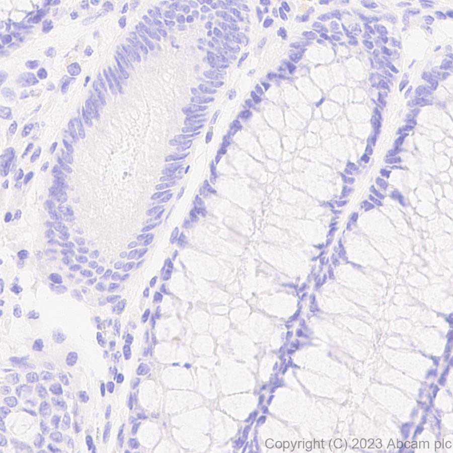 Immunohistochemistry (Formalin/PFA-fixed paraffin-embedded sections) - Anti-Mycobacterium tuberculosis Ag85B antibody [EPR28401-54] (ab312328), expandable thumbnail