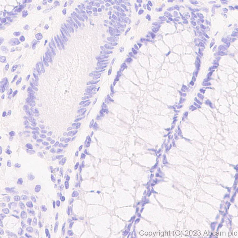 Immunohistochemistry (Formalin/PFA-fixed paraffin-embedded sections) - Anti-Mycobacterium tuberculosis Ag85B antibody [EPR28401-54] (AB312328)