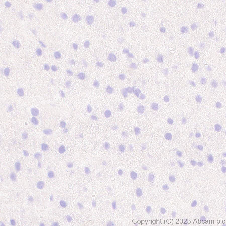 Immunohistochemistry (Formalin/PFA-fixed paraffin-embedded sections) - Anti-Mycobacterium tuberculosis Ag85B antibody [EPR28401-54] (ab312328), expandable thumbnail