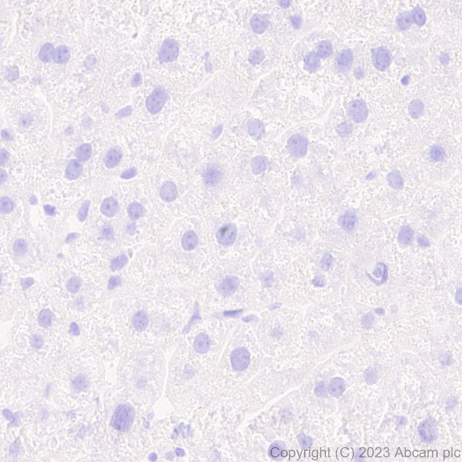 Immunohistochemistry (Formalin/PFA-fixed paraffin-embedded sections) - Anti-Mycobacterium tuberculosis Ag85B antibody [EPR28401-54] (ab312328), expandable thumbnail